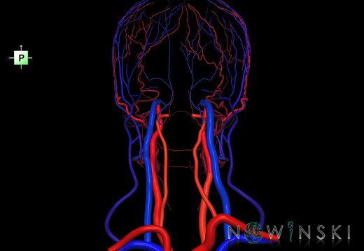 G2.T17.2-18.2.V3.C2.L0.Extracranial arteries all–Extracranial veins all