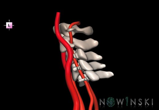 G2.T17.1-23.V2.C2.L0.Extracranial arteries main–Cervical spine