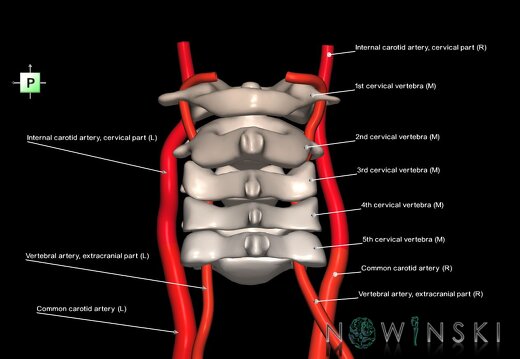 G2.T17.1-23.V3.C2.L1.Extracranial arteries main–Cervical spine