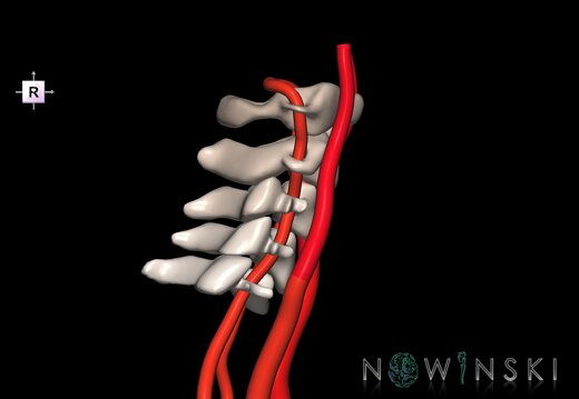 G2.T17.1-23.V4.C2.L0.Extracranial arteries main–Cervical spine