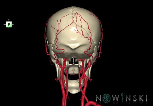 G2.T17.2-22.1.V3.C1.L0.Extracranial arteries all–Skull whole