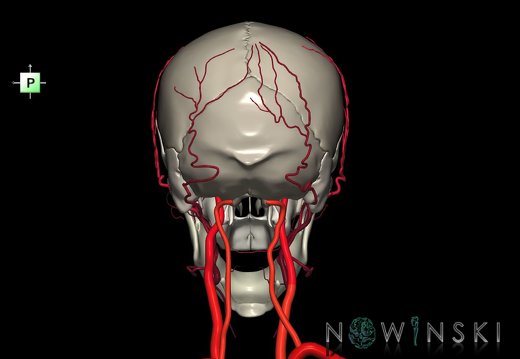 G2.T17.2-22.1.V3.C2.L0.Extracranial arteries all–Skull whole