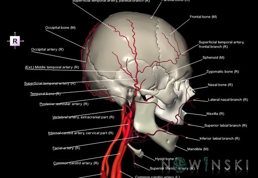 G2.T17.2-22.1.V4.C2.L1.Extracranial arteries all–Skull whole