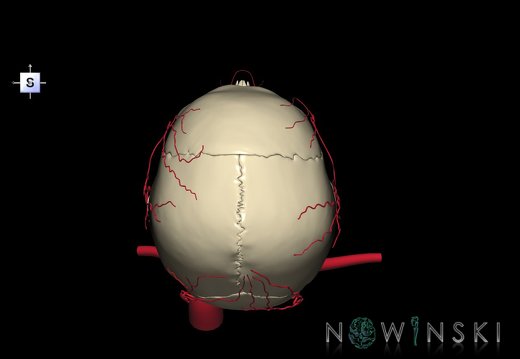 G2.T17.2-22.1.V5.C1.L0.Extracranial arteries all–Skull whole