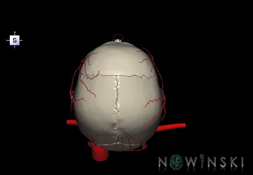 G2.T17.2-22.1.V5.C2.L0.Extracranial arteries all–Skull whole
