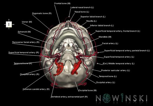 G2.T17.2-22.1.V6.C2.L1.Extracranial arteries all–Skull whole