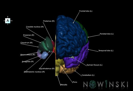 G2.T2.2-11.V1.C2.L1.Brain left–Deep nuclei right