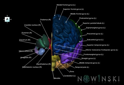 G2.T2.2-11.V1.C3-2.L1.Brain left–Deep nuclei right
