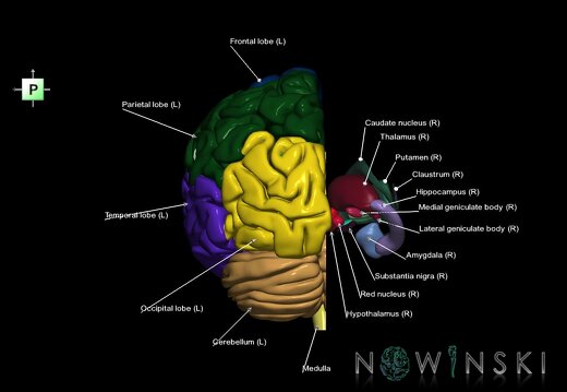 G2.T2.2-11.V3.C2.L1.Brain left–Deep nuclei right