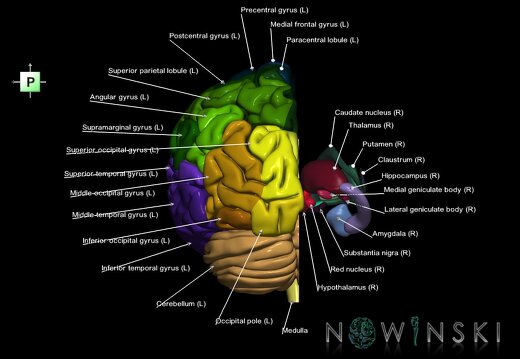 G2.T2.2-11.V3.C3-2.L1.Brain left–Deep nuclei right