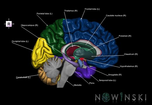 G2.T2.2-11.V4.C2.L1.Brain left–Deep nuclei right