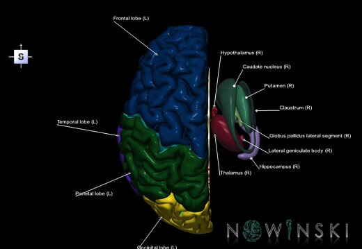 G2.T2.2-11.V5.C2.L1.Brain left–Deep nuclei right