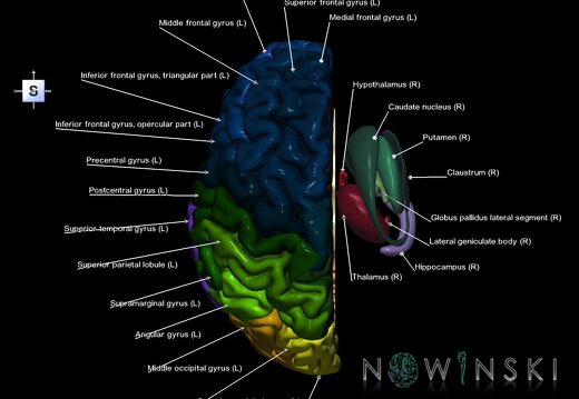 G2.T2.2-11.V5.C3-2.L1.Brain left–Deep nuclei right