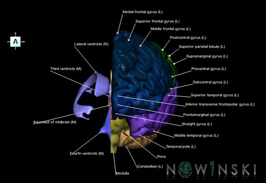 G2.T2.2-12.V1.C3-2.L1.Brain left–Cerebral ventricles right