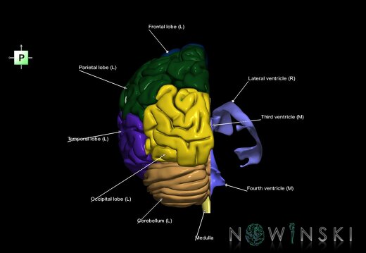 G2.T2.2-12.V3.C2.L1.Brain left–Cerebral ventricles right