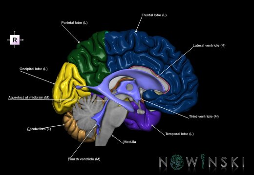 G2.T2.2-12.V4.C2.L1.Brain left–Cerebral ventricles right