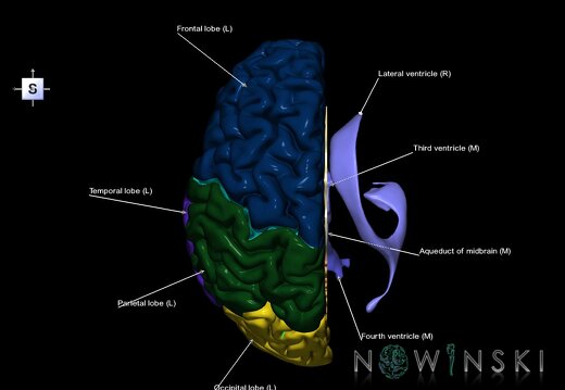 G2.T2.2-12.V5.C2.L1.Brain left–Cerebral ventricles right