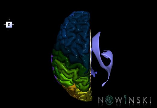 G2T2.2-12.BrainLeft-CerebralVentriclesRight