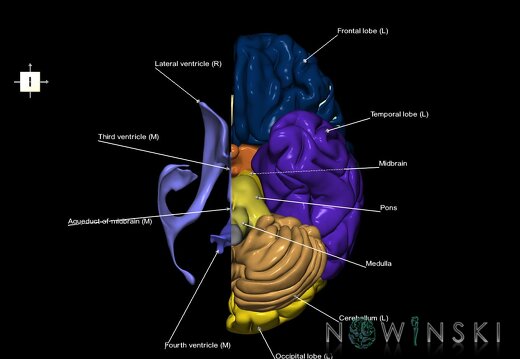 G2.T2.2-12.V6.C2.L1.Brain left–Cerebral ventricles right