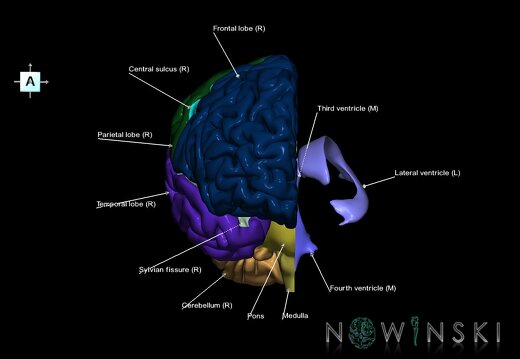 G2.T2.3-12.V1.C2.L1.Brain right–Cerebral ventricles left