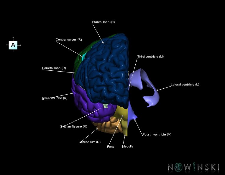 G2.T2.3-12.V1.C2.L1.Brain_right–Cerebral_ventricles_left.tiff