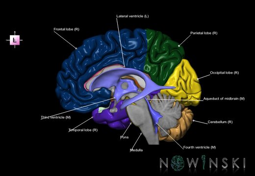 G2.T2.3-12.V2.C2.L1.Brain right–Cerebral ventricles left