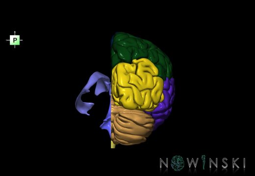 G2.T2.3-12.V3.C2.L0.Brain right–Cerebral ventricles left