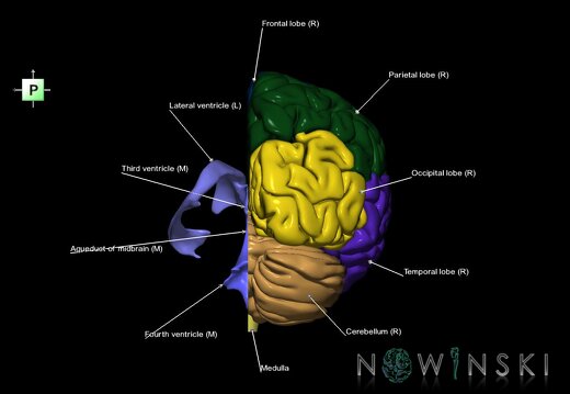 G2.T2.3-12.V3.C2.L1.Brain right–Cerebral ventricles left