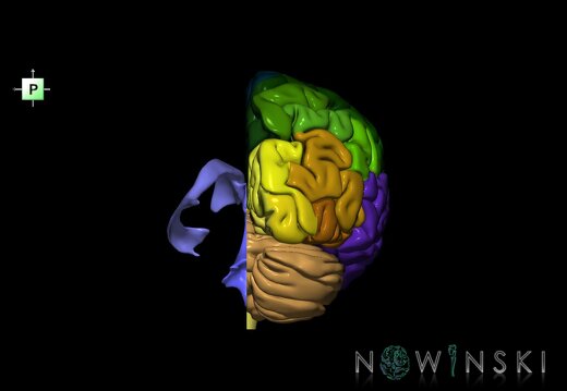 G2.T2.3-12.V3.C3-2.L0.Brain right–Cerebral ventricles left