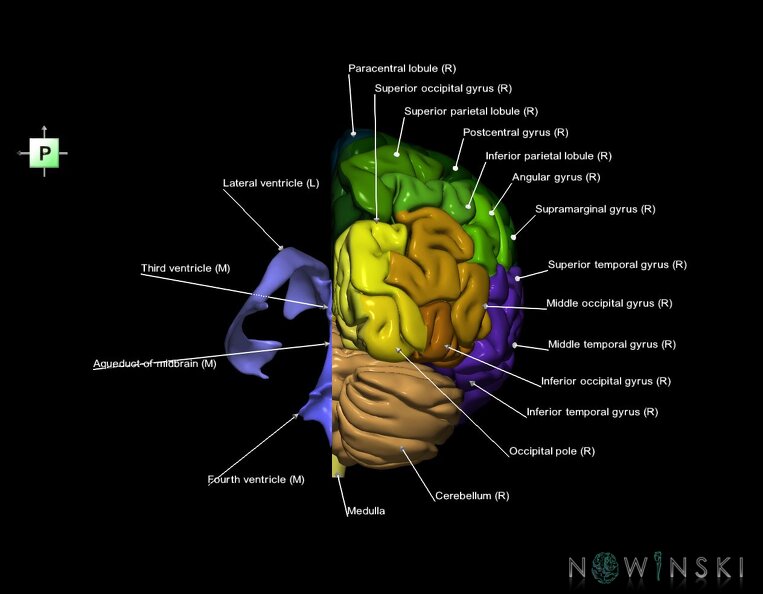 G2.T2.3-12.V3.C3-2.L1.Brain_right–Cerebral_ventricles_left.tiff