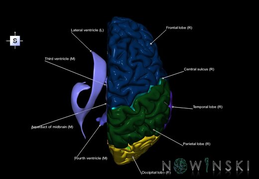 G2.T2.3-12.V5.C2.L1.Brain right–Cerebral ventricles left