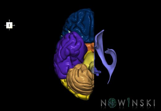 G2.T2.3-12.V6.C2.L0.Brain right–Cerebral ventricles left