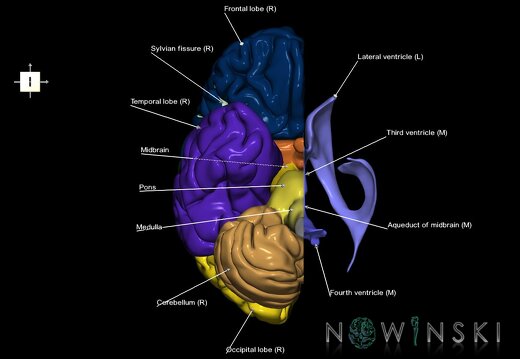 G2.T2.3-12.V6.C2.L1.Brain right–Cerebral ventricles left