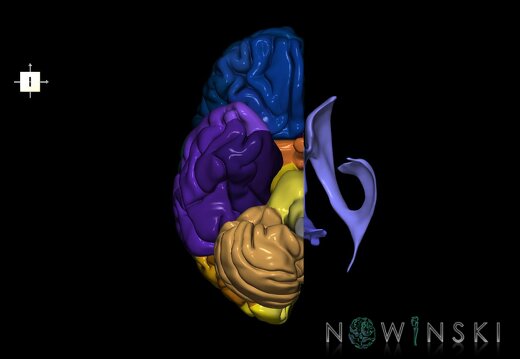 G2.T2.3-12.V6.C3-2.L0.Brain right–Cerebral ventricles left