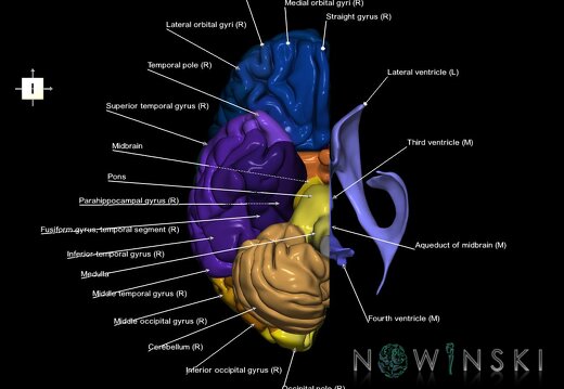 G2.T2.3-12.V6.C3-2.L1.Brain right–Cerebral ventricles left
