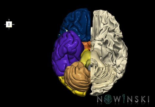 G2T2.3-13.BrainRight-WhiteMatterLeft