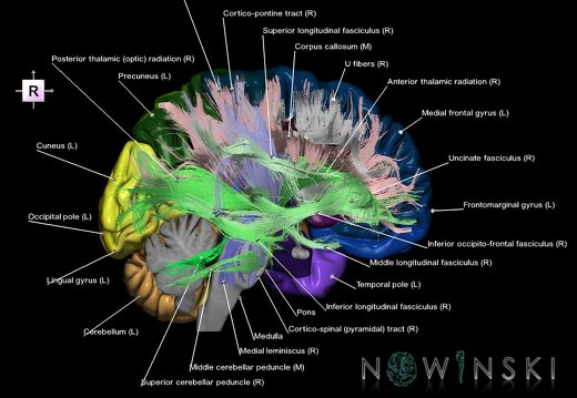 G2T2.2-14.BrainLeft-WhiteMatterTractsRight