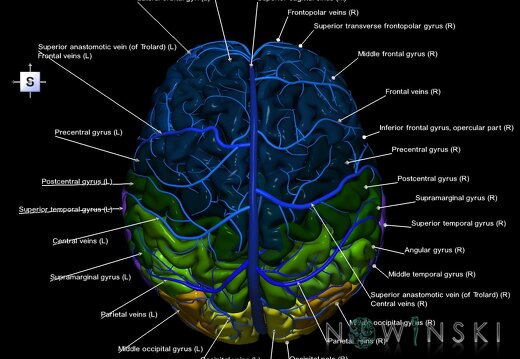 G2.T2-16.1.V5.C3-2.L1.Brain–Intracranial venous system