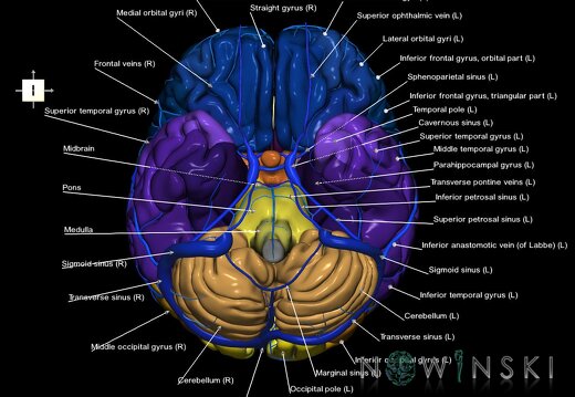 G2.T2-16.1.V6.C3-2.L1.Brain–Intracranial venous system