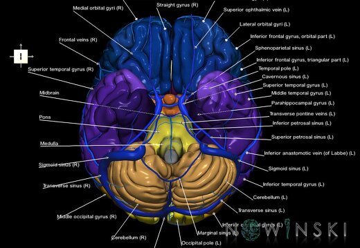 G2.T2-16.1.V6.C3-2.L1.Brain–Intracranial venous system