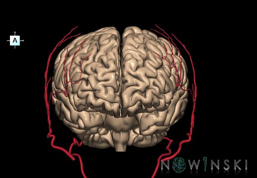 G2.T2-17.2.V1.C1.L0.Brain–Extracranial arteries