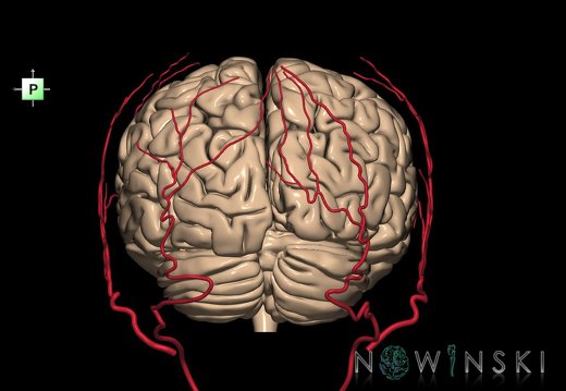 G2.T2-17.2.V3.C1.L0.Brain–Extracranial arteries