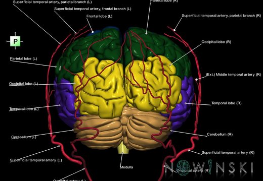G2.T2-17.2.V3.C2.L1.Brain–Extracranial arteries