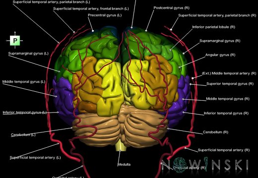 G2.T2-17.2.V3.C3-2.L1.Brain–Extracranial arteries