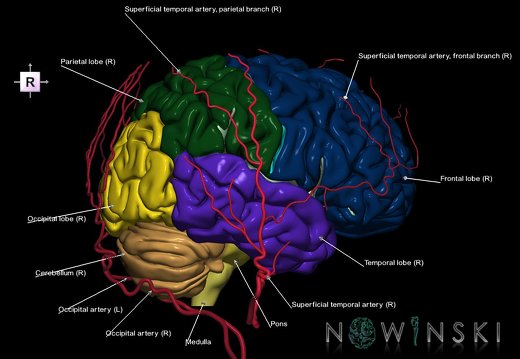 G2.T2-17.2.V4.C2.L1.Brain–Extracranial arteries