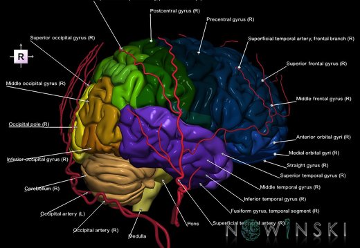 G2.T2-17.2.V4.C3-2.L1.Brain–Extracranial arteries