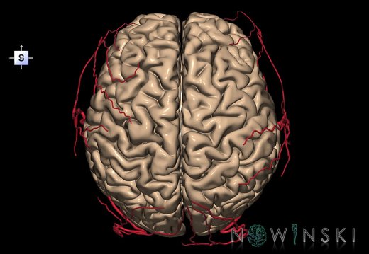 G2.T2-17.2.V5.C1.L0.Brain–Extracranial arteries