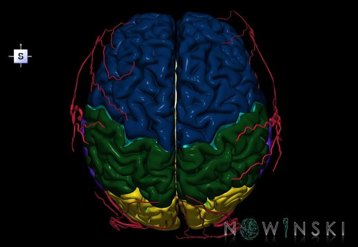 G2.T2-17.2.V5.C2.L0.Brain–Extracranial arteries