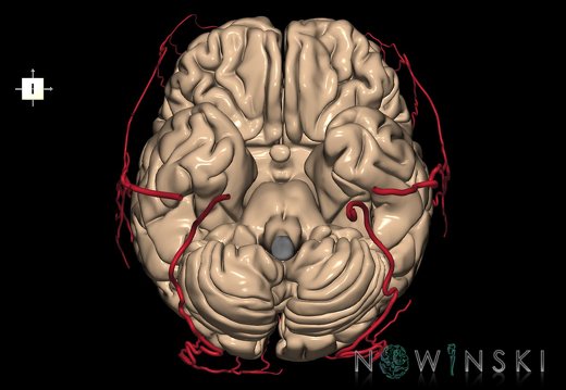 G2.T2-17.2.V6.C1.L0.Brain–Extracranial arteries