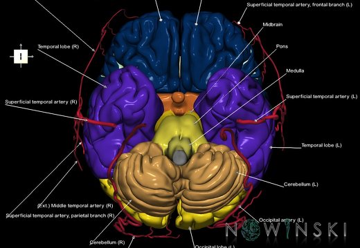 G2.T2-17.2.V6.C2.L1.Brain–Extracranial arteries